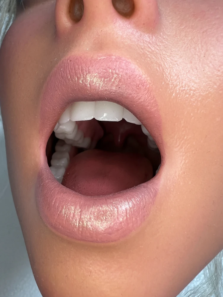 Zelex Inspiration series mouth